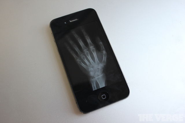 skelton hand on iphone screen